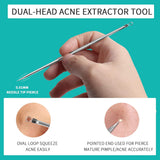 Extractor de espinillas WSYUB, acero inoxidable, kit de acné