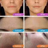 Nuevo Sérum Facial Vitamina C 2024, Hidratante y Iluminador