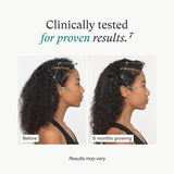 Cápsulas veganas para crecimiento del cabello, mujeres 18-44 años