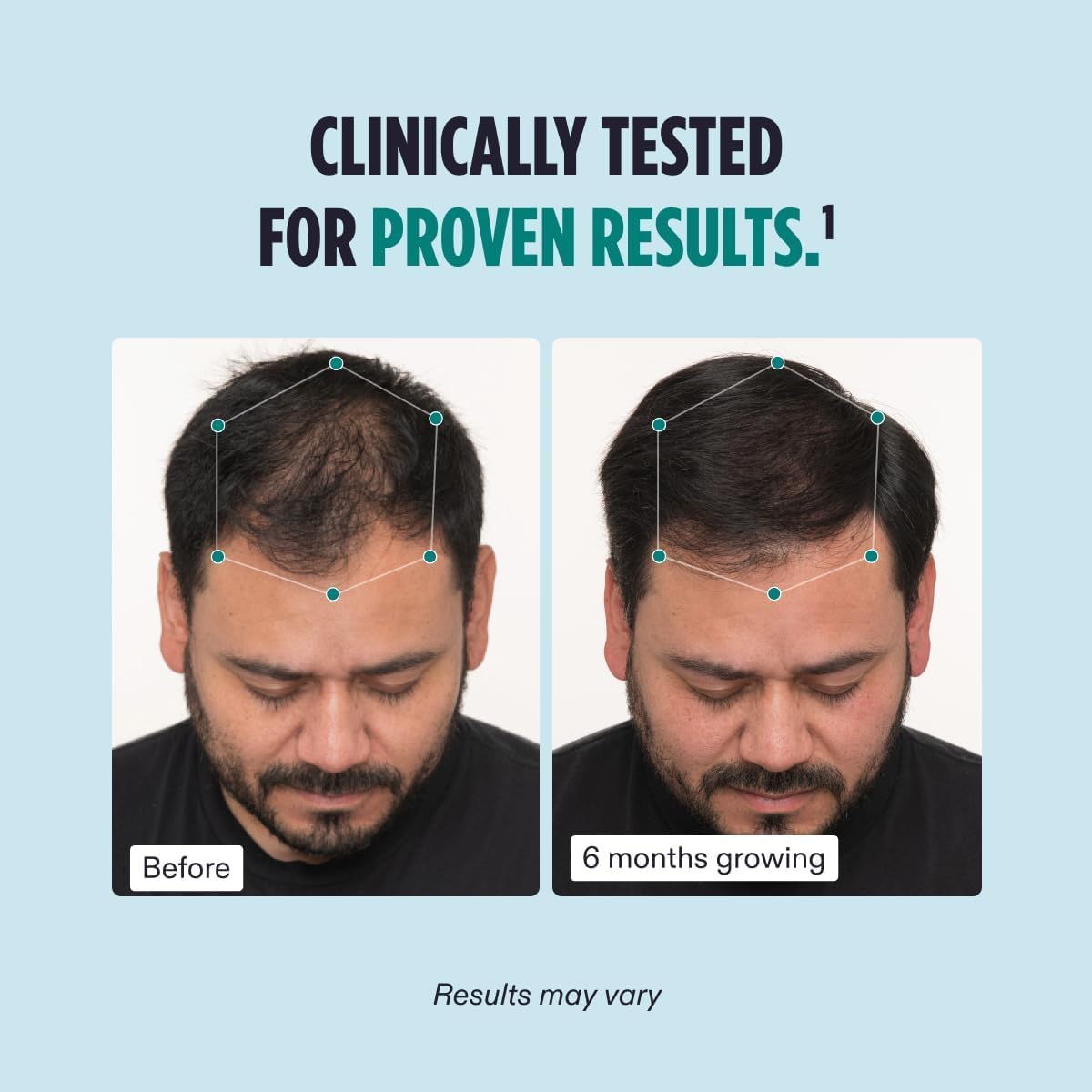 Suplementos para cabello más grueso y cuero cabelludo sano