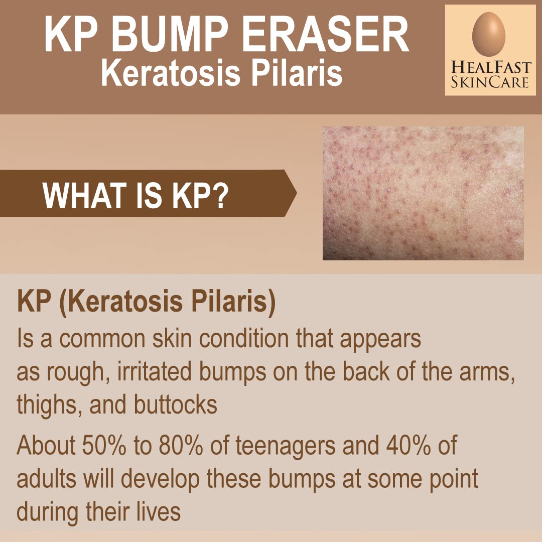 Crema para piel propensa a KP y poros obstruidos HealFast