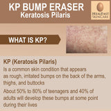 Crema para piel propensa a KP y poros obstruidos HealFast