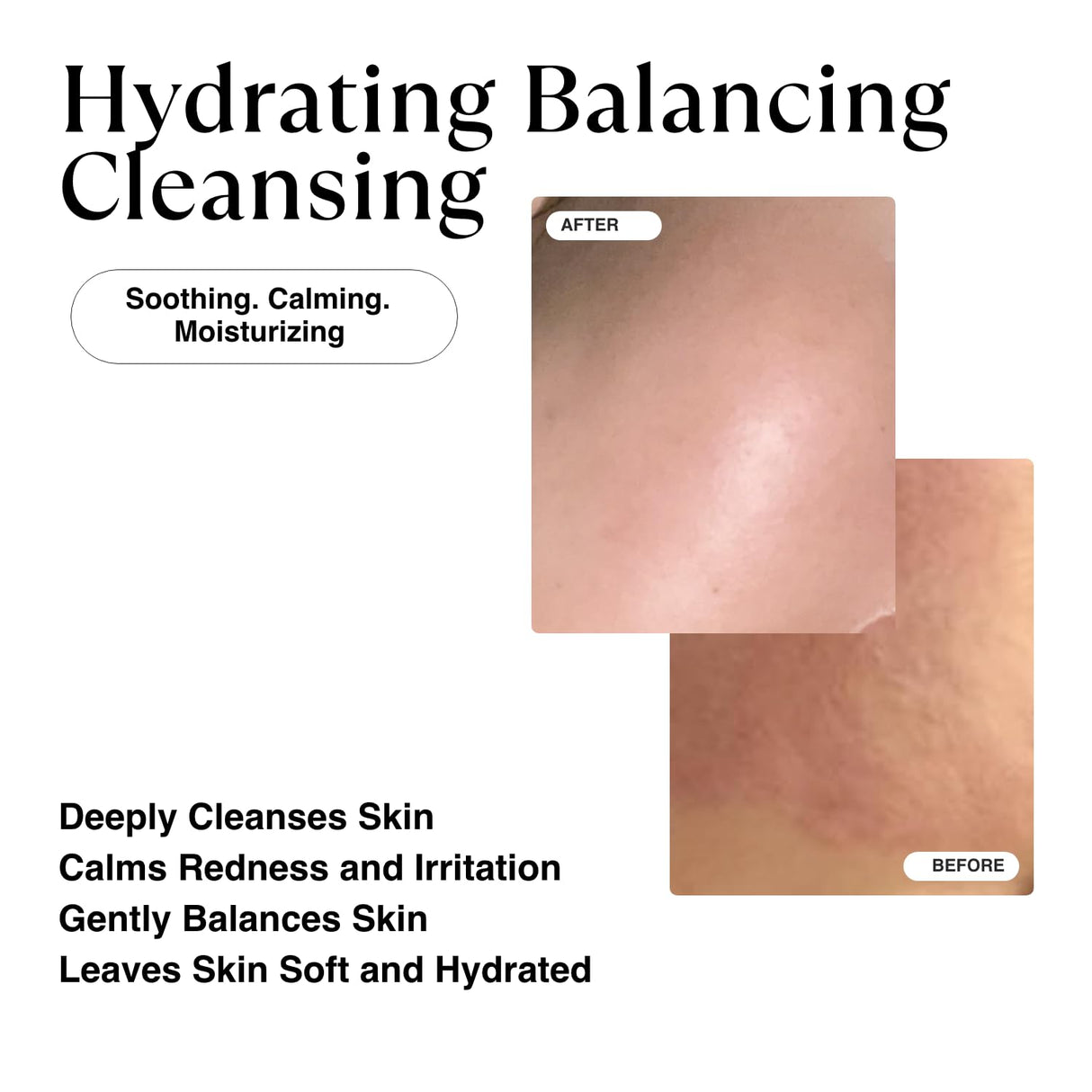 Limpiador Facial Hidratante Coreano para Piel Sensible