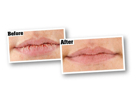 Bálsamo labial reparador de labios sin perfume