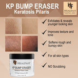 Crema para piel propensa a KP y poros obstruidos HealFast