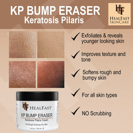 Crema para piel propensa a KP y poros obstruidos HealFast