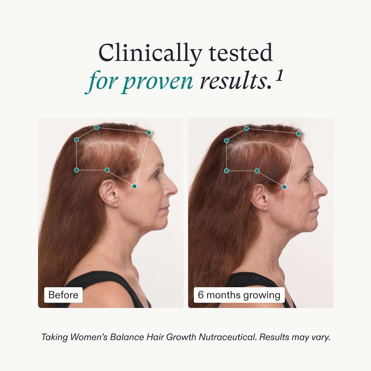Suplemento y suero para el crecimiento del cabello para mujer 45+