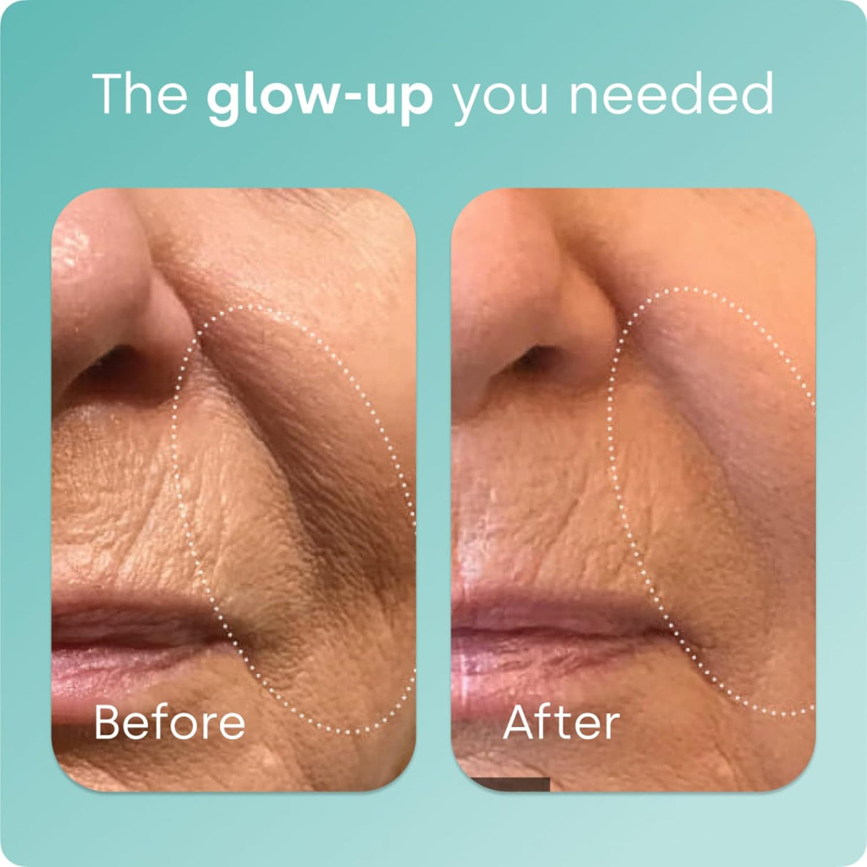 Biosil Collagen Booster, suplemento de colágeno, 60 días