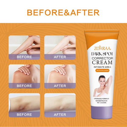 Crema corrector de manchas oscuras ZOHRAA para cara y cuerpo