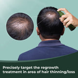 Thik&amp;Fix Spray para el crecimiento del cabello, spray para engrosar el cabello para hombres y mujeres, aumenta el volumen y la textura, humecta el cuero cabelludo y el cabello, reduce los enredos (3.38 onzas líquidas)