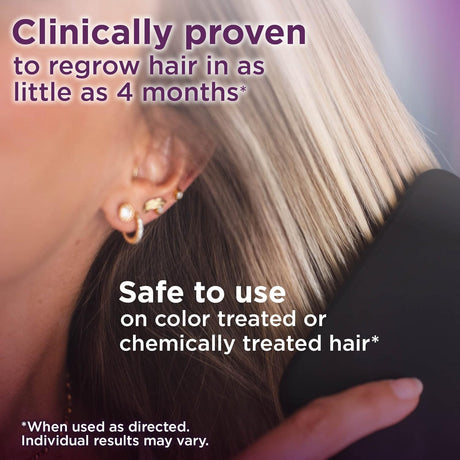 Solución Tópica de Minoxidil 2% para Mujeres, Amazon Basic Care