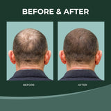 Thik&amp;Fix Spray para el crecimiento del cabello, spray para engrosar el cabello para hombres y mujeres, aumenta el volumen y la textura, humecta el cuero cabelludo y el cabello, reduce los enredos (3.38 onzas líquidas)