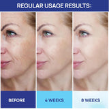 Crema de retinol para cara con ácido hialurónico MOONRIN
