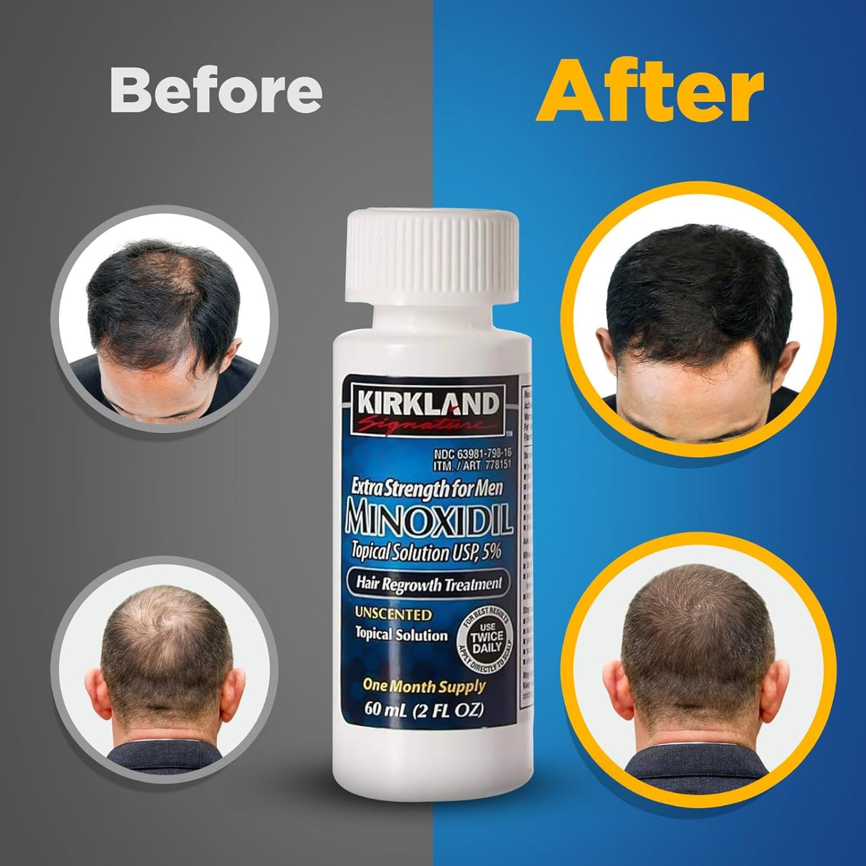 Crecimiento del cabello extra fuerte