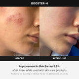 Dispositivo de Cuidado de la Piel N°1 - Refuerzo de Brillo Facial Age-R Booster H