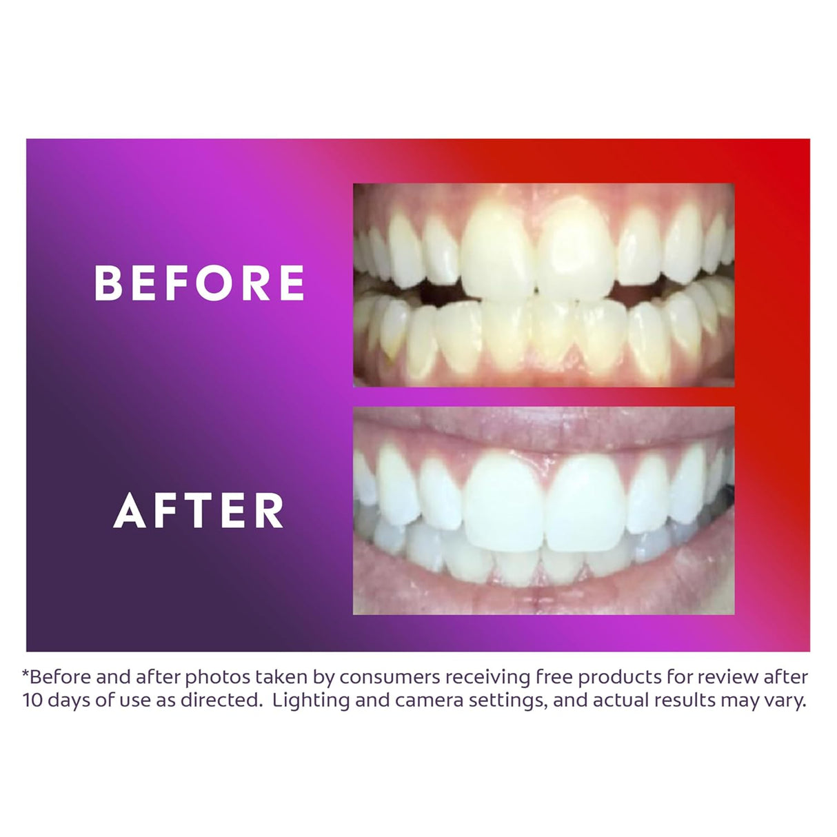 Kit de Blanqueamiento Dental LED ComfortFit con Bolígrafo