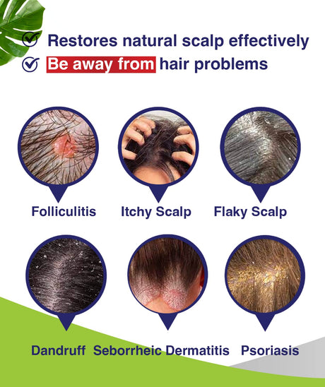 PHARMBANNER Foliculitis champú para dermatitis seborreica