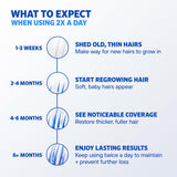 Rogaine Minoxidil 5% Solución Tópica para Hombre, 2 fl oz