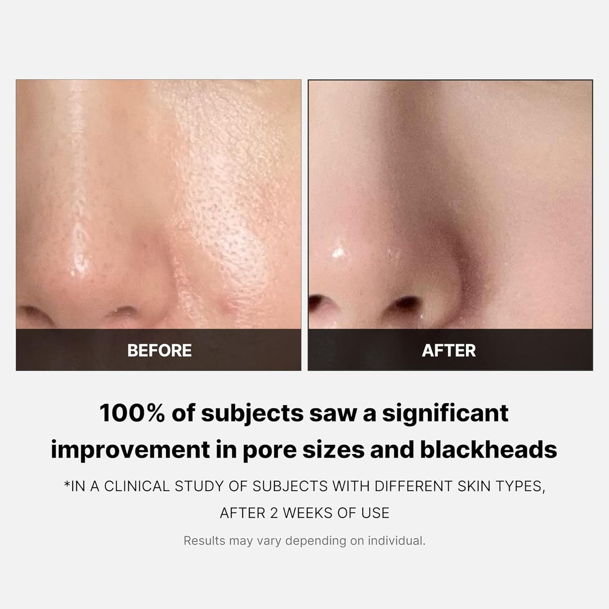Almohadillas con tónico facial Medicube reductores