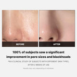 Almohadillas con tónico facial Medicube reductores