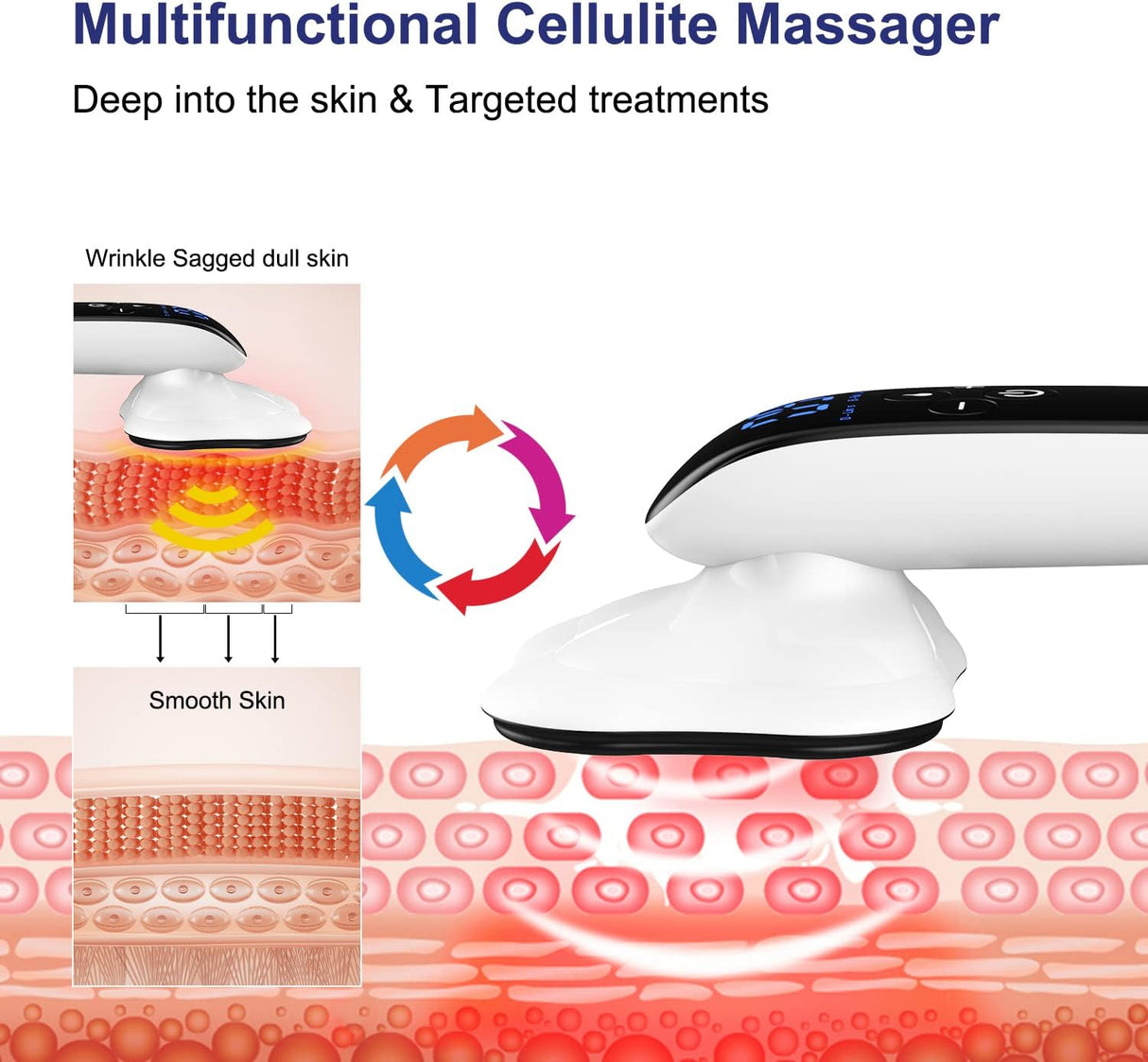 Masajeador de Celulitis, Pro Max, 4 Cabezas, Inalámbrico