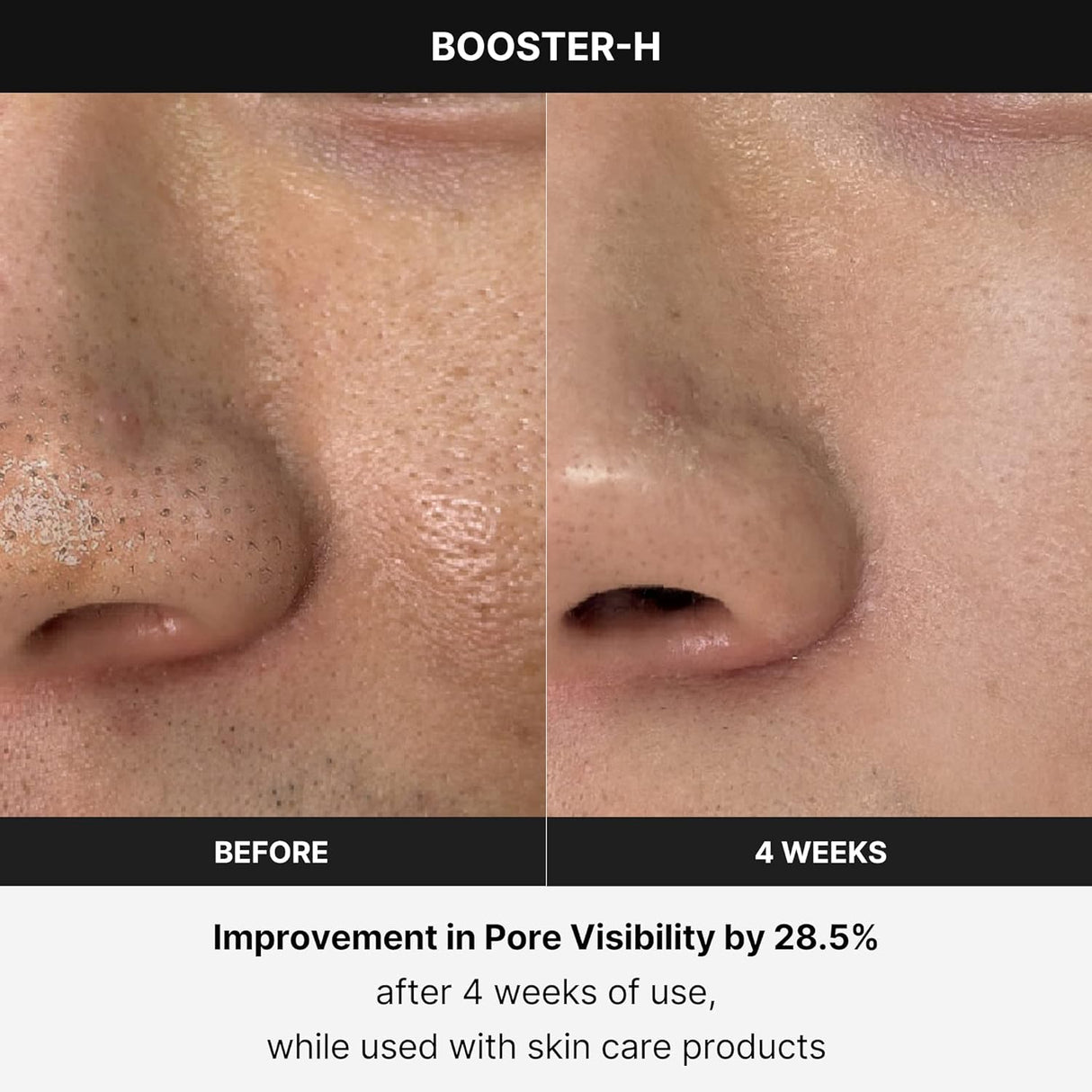 Dispositivo de Cuidado de la Piel N°1 - Refuerzo de Brillo Facial Age-R Booster H