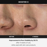 Dispositivo de Cuidado de la Piel N°1 - Refuerzo de Brillo Facial Age-R Booster H