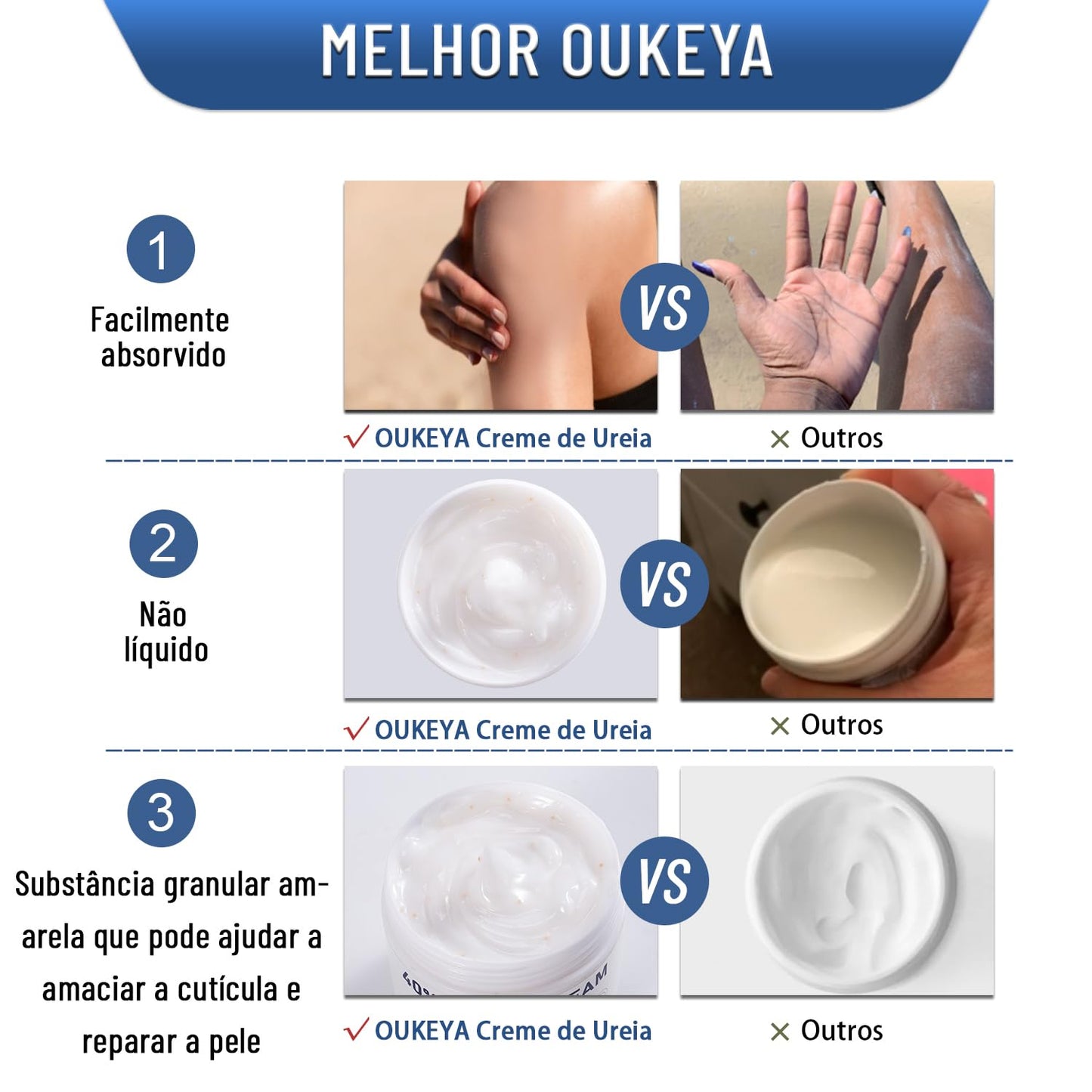 Crema de urea al 40% para pies y manos secos y agrietados