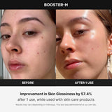 Dispositivo de Cuidado de la Piel N°1 - Refuerzo de Brillo Facial Age-R Booster H