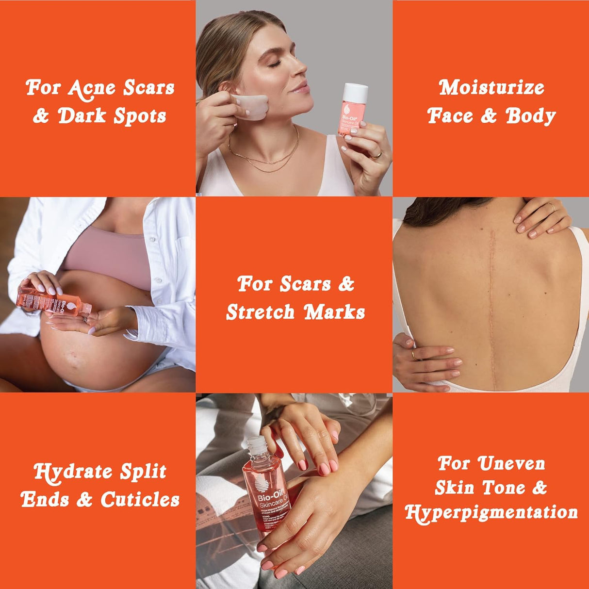 Aceite multiuso Bio-Oil para el cuidado de la piel
