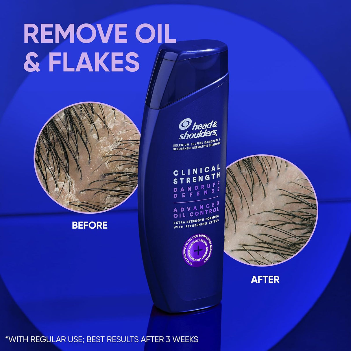 Champú para caspa de doble paquete Head and Shoulders