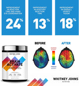 Suplementos Alimenticios cerebral de enfoque y memoria