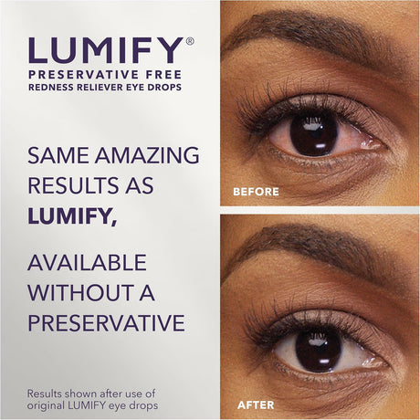 Gotas para los ojos LUMIFY, alivio enrojecimiento, 20 viales