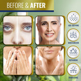 Loción de mantequilla corporal con Retinol Advanced Clinicals