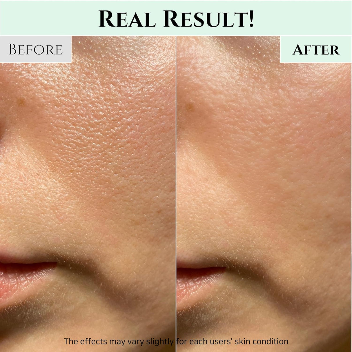 Limpiador Facial en Gel, Limpieza Profunda, para Todo Tipo de Piel