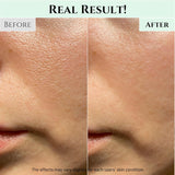 Limpiador Facial en Gel, Limpieza Profunda, para Todo Tipo de Piel