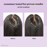 Suplemento Lemme Grow para el Crecimiento del Cabello, 1 Mes