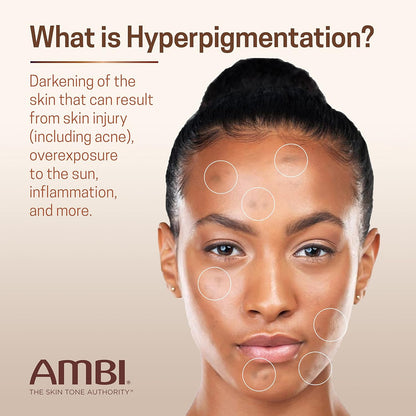 Tratamiento de hiperpigmentación Ambi corrector de manchas