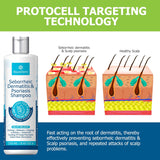 Roycederm Champú para la psoriasis para dermatitis