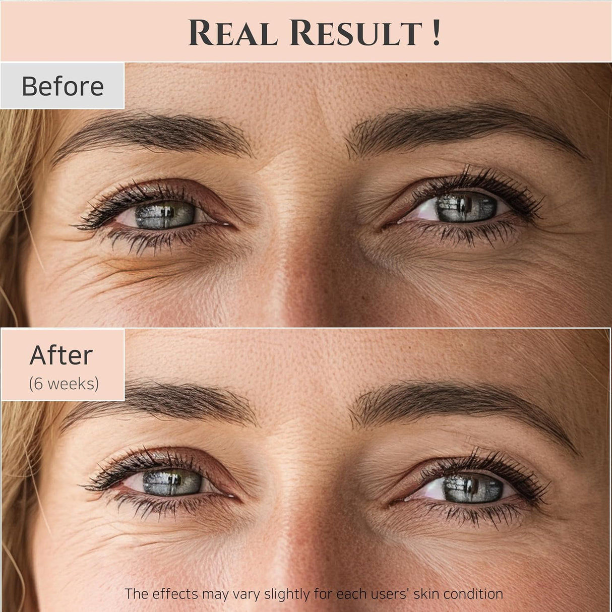 Suero para ojos con corrección de niacinamida retiniana