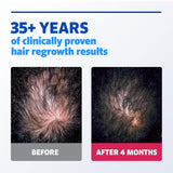 Rogaine Minoxidil 5% Solución Tópica para Hombre, 2 fl oz