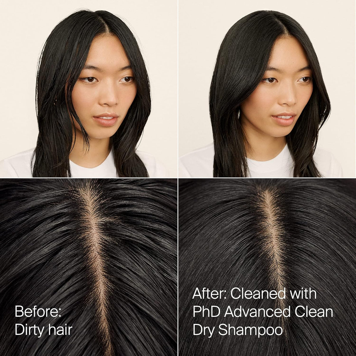 Shampoos y Acondicionadores seco para mujeres y hombres