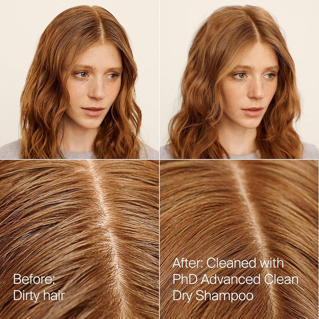Shampoos y Acondicionadores seco para mujeres y hombres