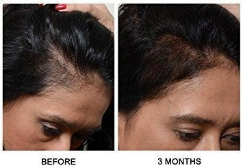 Aceite Para El Cabello Amla (8 Oz) De Vadik Herbs Aceite